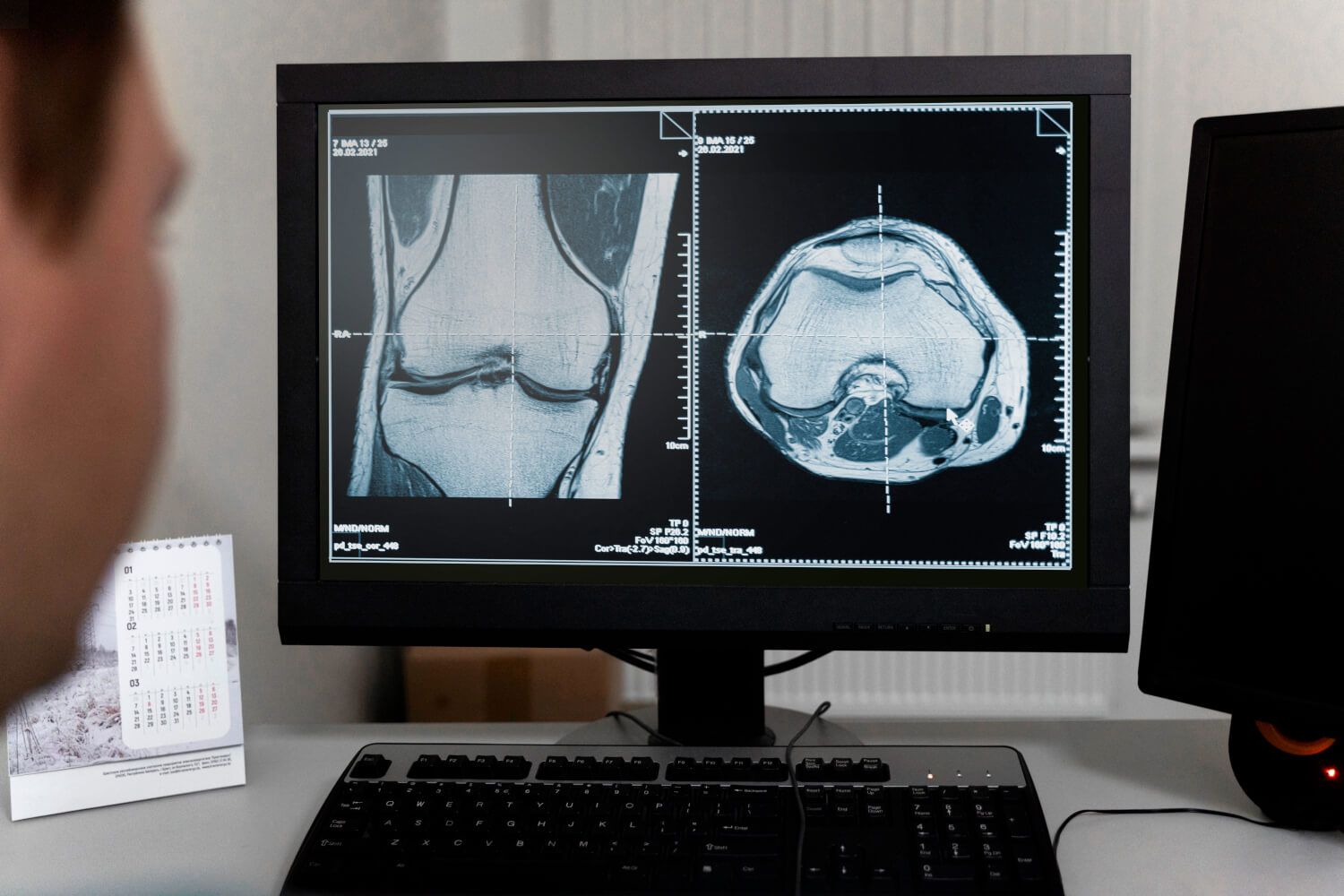 Визуализация в медицине: что это такое, современные методы применения |  SberMed AI